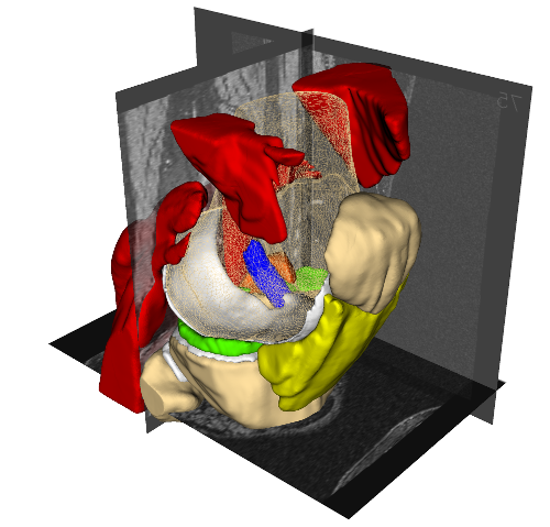 Segmented Knee Joint